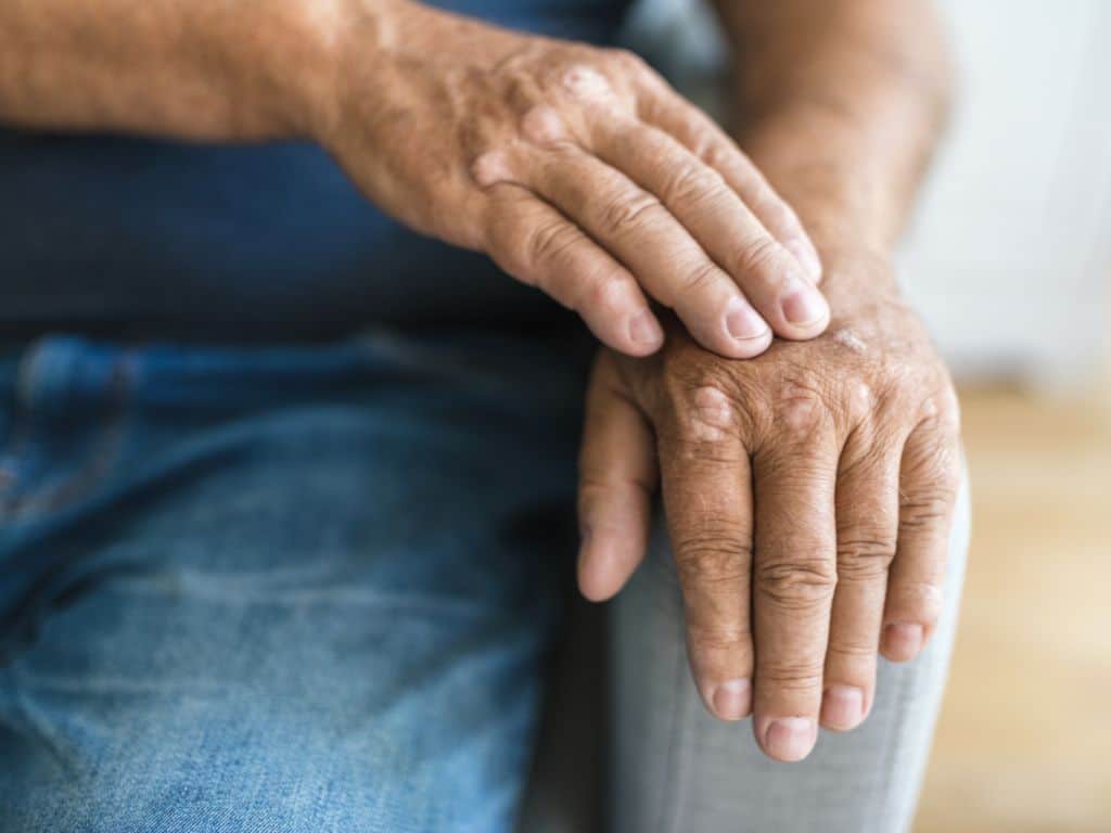 Be mindful of elderly loved ones skin conditions